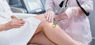 Laser Hair Removal